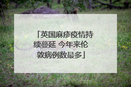 英国麻疹疫情持续蔓延 今年来伦敦病例数最多